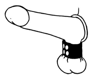 107-0 Stretcher & Cock Ring (metal) - Plain