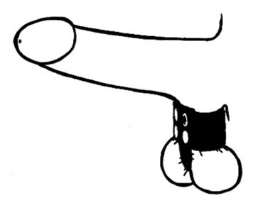 105-1 Stretcher/divider