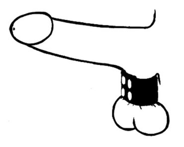 105-0 Stretchers - Plain